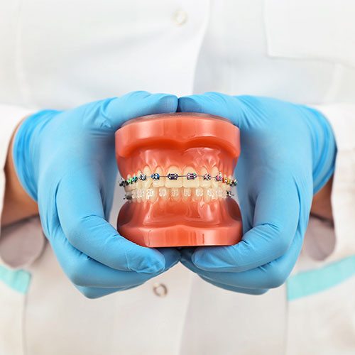 Brampton orthodontist offers traditional orthodontics
