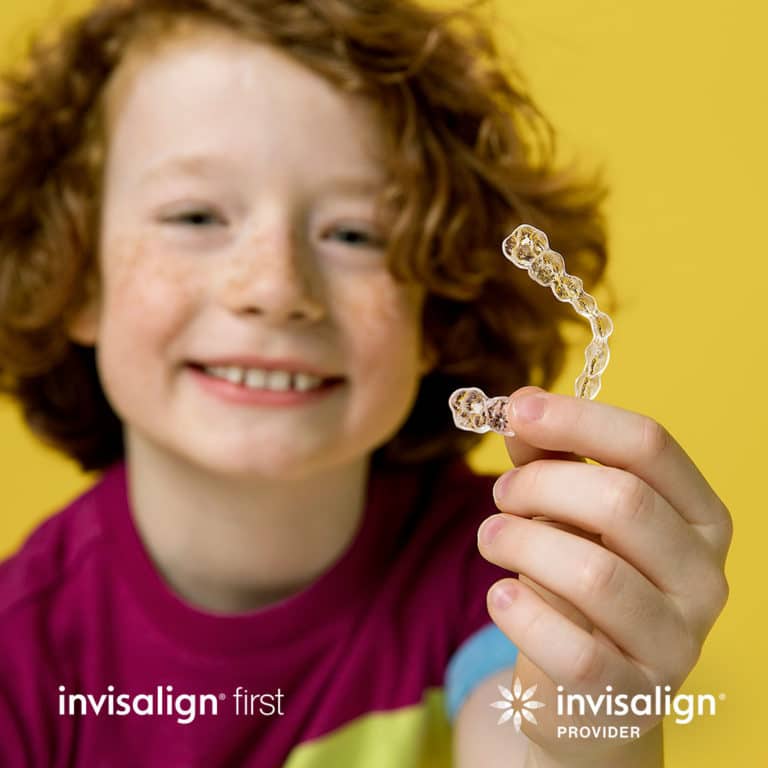 Invisalign in Brampton